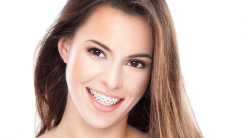 При установке любой брекет-системы диагностика в ПОДАРОК!