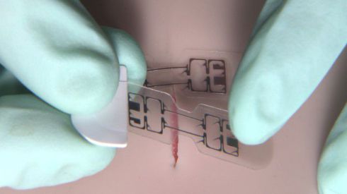 Изобретен пластырь, заживляющий раны