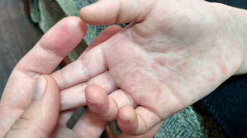 В Киеве цирк «Кобзов» стал разносчиком страшной болезни среди детей