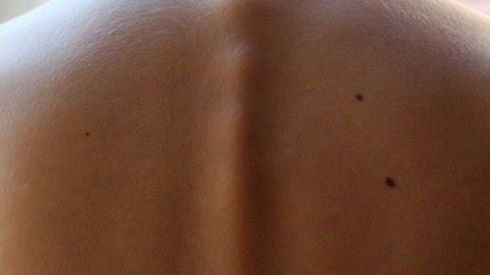 Это упражнение избавит от сколиоза, поставив позвонки на место