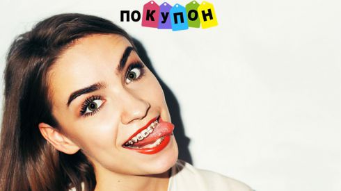 Брекеты - идеальное решение неправильного прикуса