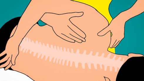 Соли в позвоночнике – их надо разбивать?