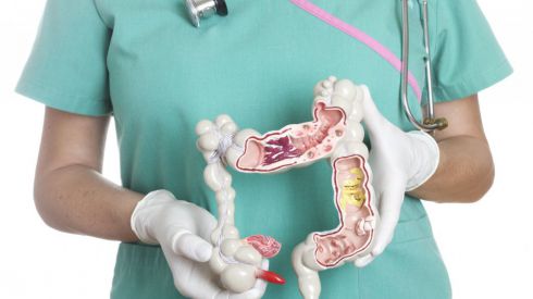 Полипы толстой кишки – что нужно знать об этих наростах