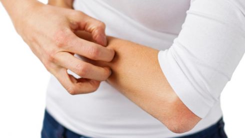 Какие существуют разновидности экземы? (ФОТО)