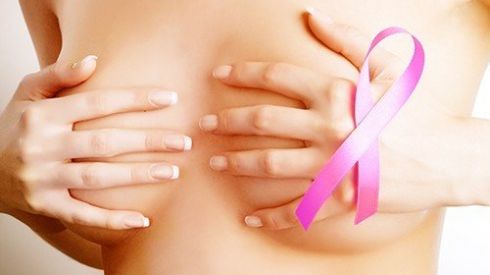 Что нужно знать о раке молочной железы