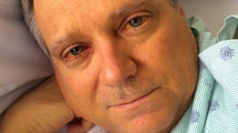 После приема популярных БАДов у американца отказала печень