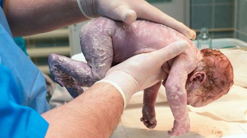 Что ощущает ребенок во время рождения