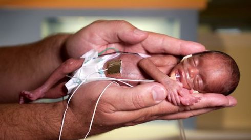 Интересные факты о недоношенных детях