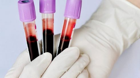 Какие продукты разжижают кровь и растворяют тромбы?