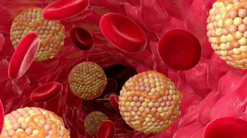 Повышенный холестерин: 10 главных признаков