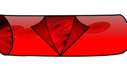 5 причин повышенного уровня холестерина