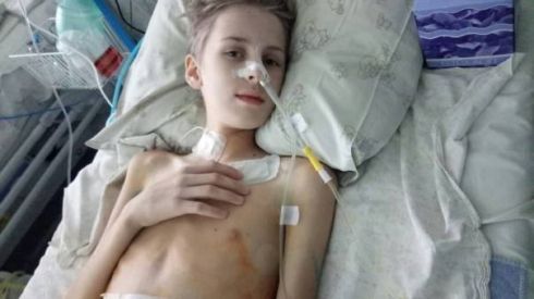 90 % удаленного кишечника и мечта поесть: Денису срочно нужна помощь