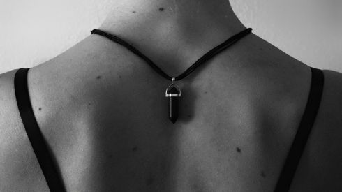 Перерождение родинки: 5 признаков