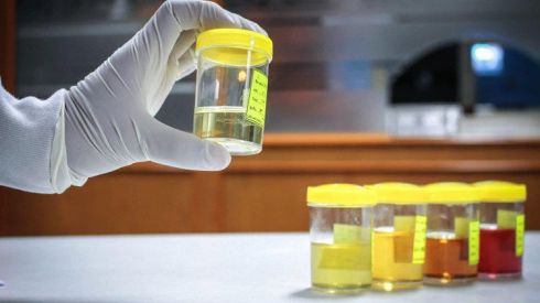 Как самостоятельно расшифровать анализ мочи