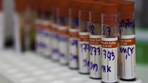 Как снизить уровень холестерина без лекарств