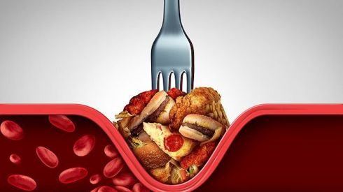 Простые способы снизить холестерин