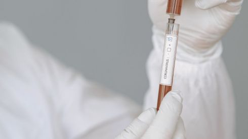 Кличко: что делать, если вам отказали в бесплатном тесте на COVID-19?