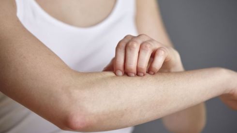 Обережно - лишаи?!