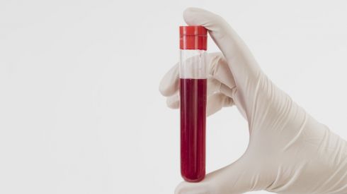 Безопаснее аспирина: продукты для разжижения крови