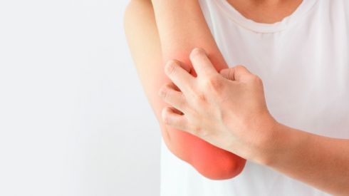 З якими проблемами стикаються люди з псоріазом в повсякденному житті? ?