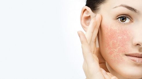 Як доглядати за чутливою шкірою?