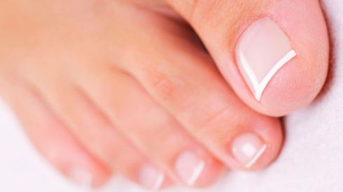 Нігтьовий панариций