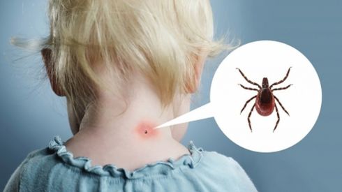 Клещи...Тест на боррелиоз