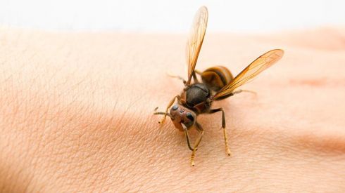 Первая помощь при укусах насекомых