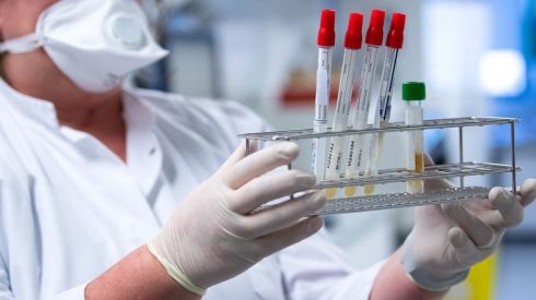 Дельта-штамм уже в Украине. Чем вирус «Дельта» отличается от классического ковида?