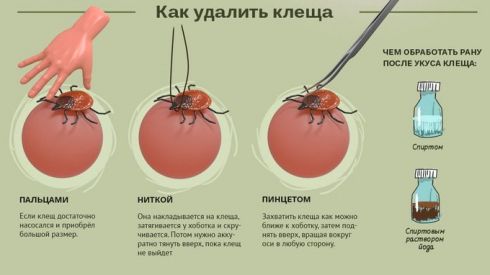 Як правильно витягнути кліща