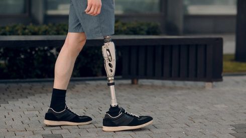 Цивільні дорослі та діти мають право на безкоштовне протезування: як це працює?