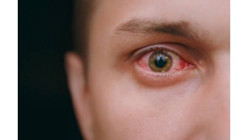 Відчула, як повзає паразит: з ока жінки дістали гельмінта