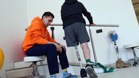 За один месяц в Украине производят 2 тысячи протезов нижних конечностей и 200 – верхних.