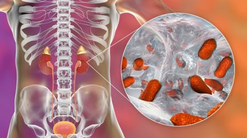 Пієлонефрит: причини, симптоми, лікування