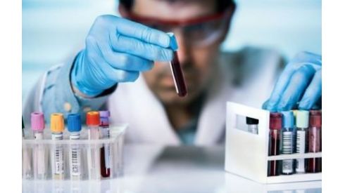 Інфікування сифілісом та гонореєю зростає рекордними темпами