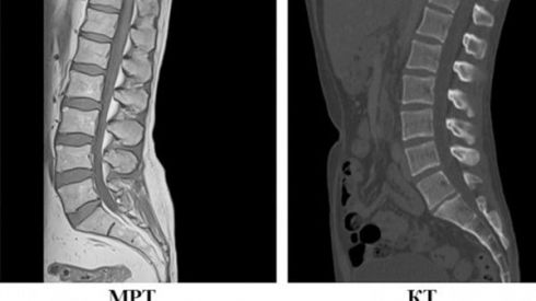 КТ і МРТ: у чому різниця?