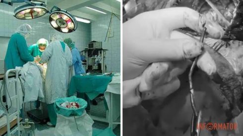 В Днепре спасли военного с гвоздем в мозгу: 5 часов операции и настоящее чудо