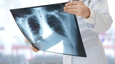 Що краще: флюорографія чи рентген?