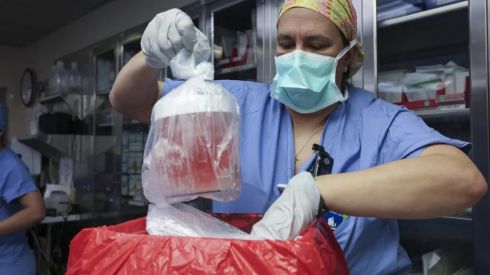 Пересадка нирки закінчилася смертю від сказу