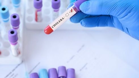 У Польщі вперше за шість років виявили холеру: пацієнтка в тяжкому стані, десятки людей ізольовані