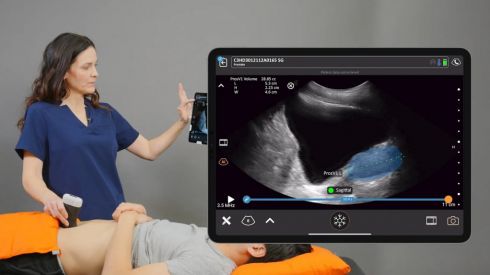 Штучний інтелект навчився «бачити» рак і хвороби серця на звичайному УЗД