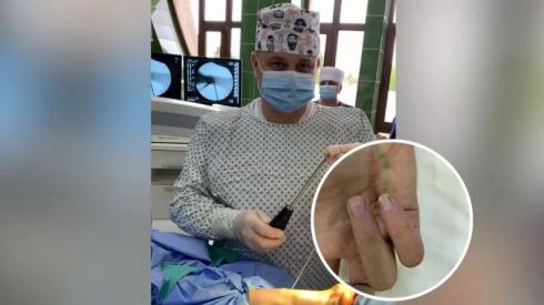 В Черновцах врачи восстановили подростку часть пальца, которую ему откусили во время драки