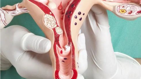 10 ключових факторів ризику раку шийки матки, про які варто знати кожній жінці