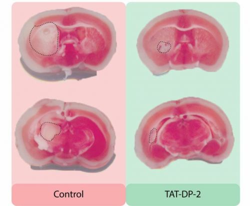 Белок ТАT-DP-2 блокирует отток калия после инсульта