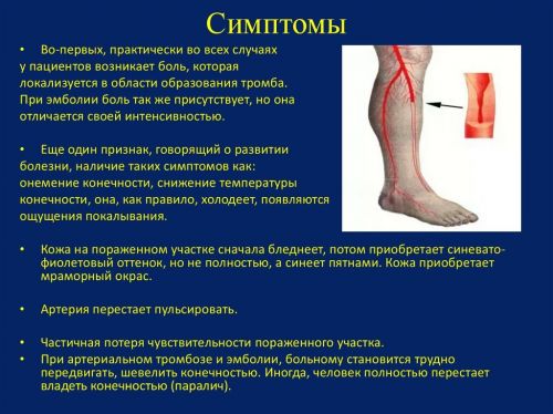 Симптомы тромбоза