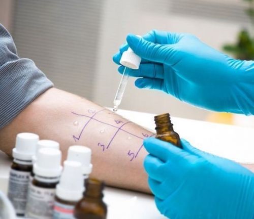 Аллергопробы