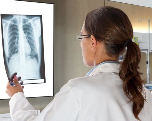 Через месяц после лечения пневмонии необходимо сделать повторный рентген легких