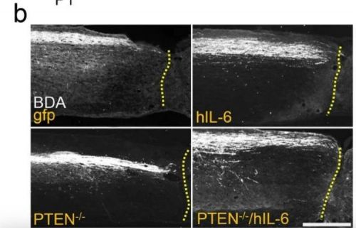 Нервные волокна смогли срастись