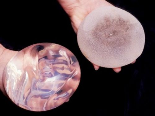 Салиновый и силиконовый импланты