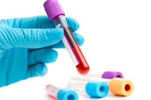 Для определения уровня лейкоцитов нужен общий анализ крови